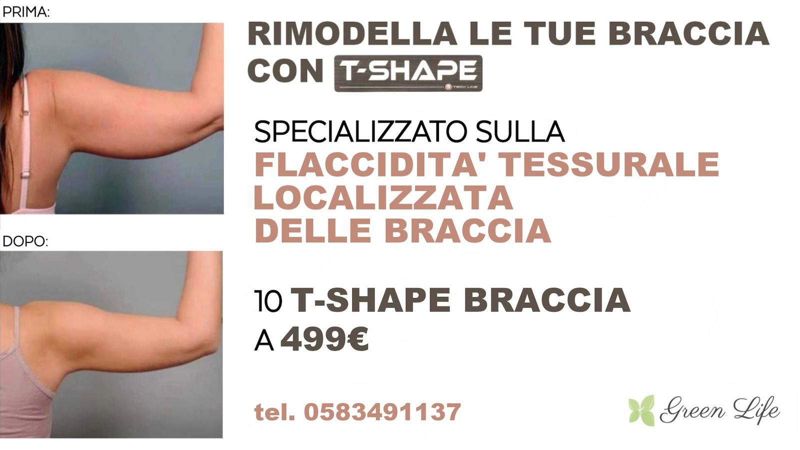 T-Shape Braccia